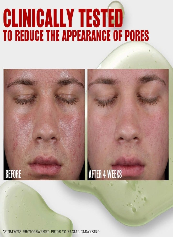 Thayers Oil Balancing and Cooling Jelly Toner, Pore Reducing Facial Toner That Mattifies and Hydrates, Skin Care for Combination to Oily Skin, 12 Fl Oz - Image 3