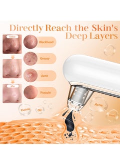 ASIV Blackhead remover, vacuum pore extractor, blackhead remover, suitable for facial blackhead extractor, pore vacuum acne extractor, skin label removal tool, pore cleaner, with USB charging, 4 modes, 5 suction heads  - Image 2