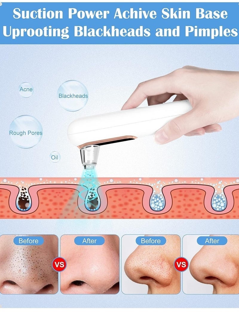 ASIV Electric Vacuum Blackhead Remover (USB Charging) Professional - Image 4