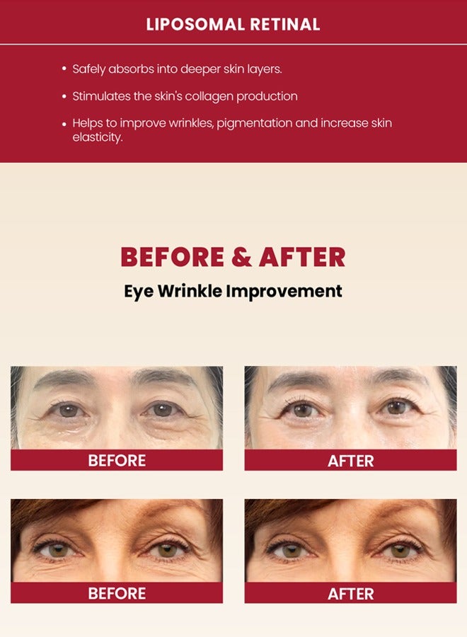 K-SECRET KSECRET SEOUL 1988 Eye Cream Set (2-Pack): 4% Retinal Liposome + Fermented Bean for Wrinkle Repair, Brightening & Firming (Packaging May Vary) - Image 5