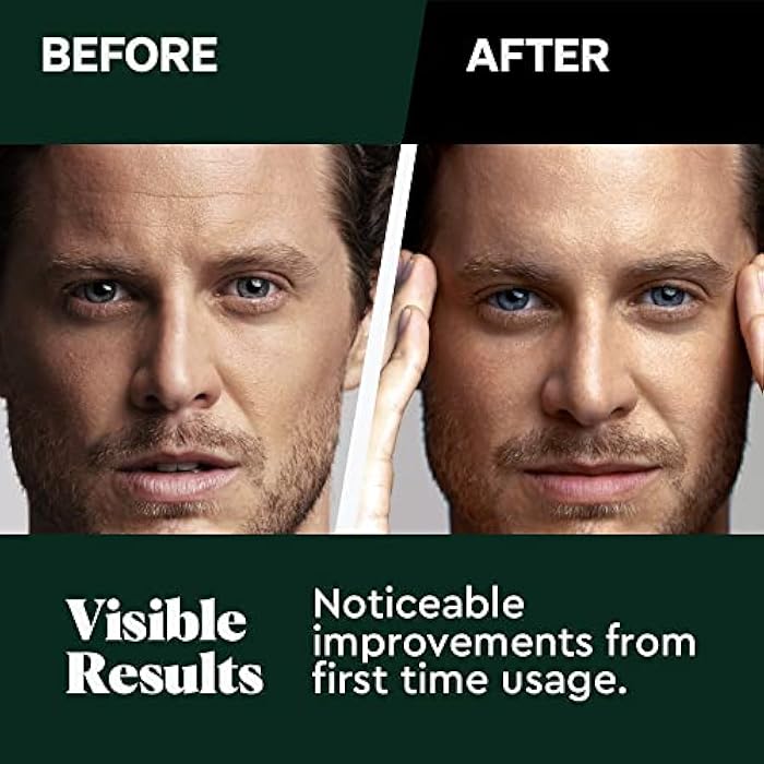 The Wolf Project Wolf Project Activated Charcoal Beads Korean Face Wash - Charcoal Face Cleanser with Oil Control Prevents Acne, Deeply Cleanses, Hydrates and Moisturizes Skin. Natural Facial Cleanser - Image 5