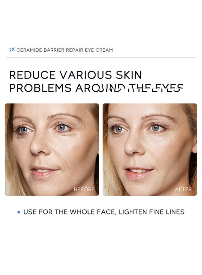 لايكو كريم العين لإصلاح حاجز السيراميد 7X ، كريم السيراميد تحت العين ، كريم العين المرطب المضاد للشيخوخة للتجاعيد ، كريم تجاعيد العين مع رأس التدليك ، كريم العين للهائرال السوداء للنساء والرجال ، مرطب العين لجميع أنواع البشرة 20 جرام - Image 4