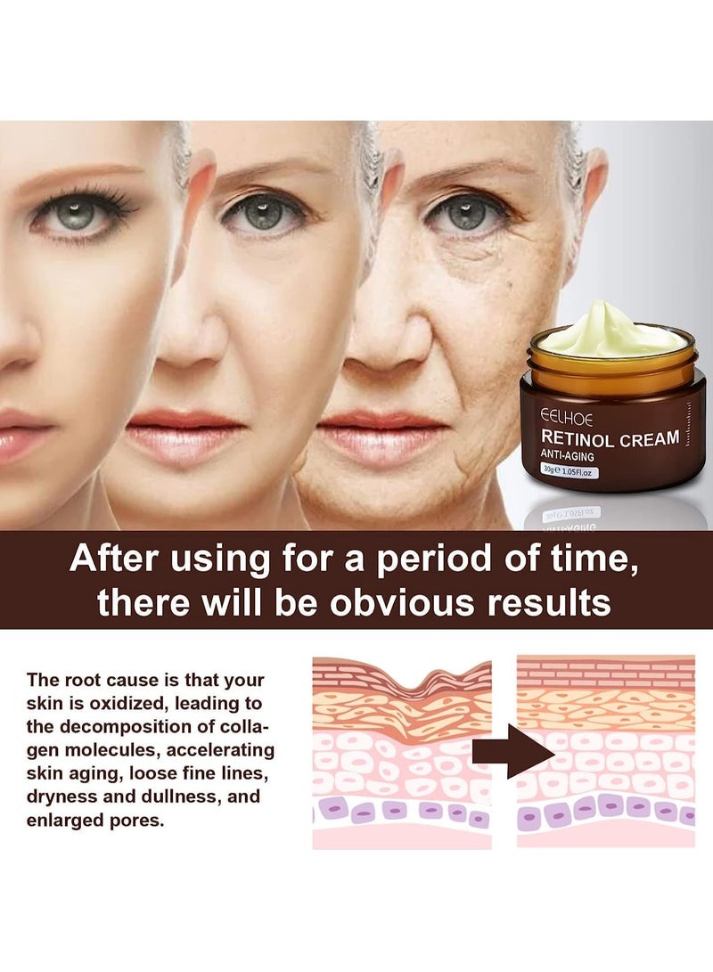 EELHOE كريم وجه ريتينول، كريم وجه مضاد للتجاعيد ريتينول، كريم مضاد للشيخوخة ريتينول، مرطب وجه ريتينول، كريم ريتينول مع حمض الهيالورونيك، بشرة أكثر تماسكًا وإشراقًا (30 جرام) - Image 3