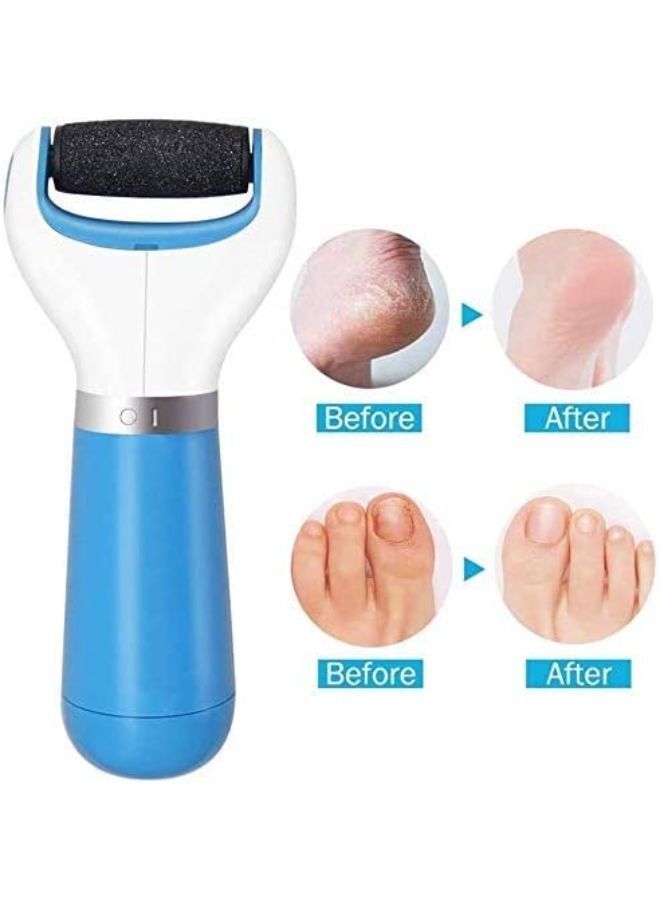 USB Rechargeable Electronic Foot Callus Remover - Image 1