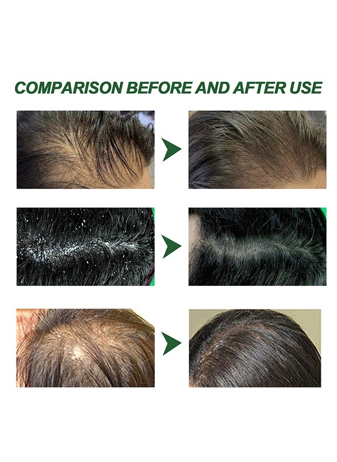 SOUTH MOON - Ginger Hair Regrowth Green Ginger,Hair Nourishing Growth Spray, Green Ginger Hair Regrowth Spray, Moisturizing Fast Growth Anti-Defixation Spray Growth Solution, Organic Growth Plus Nourishing Ginger Spray for Men and Women(100ML) - Image 1