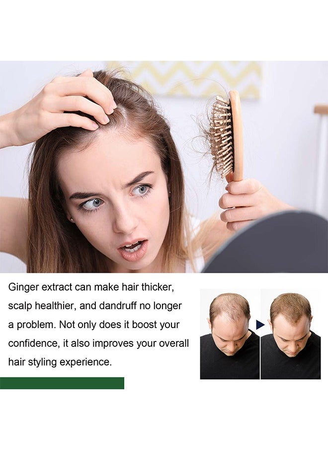 SOUTH MOON - Ginger Hair Regrowth Green Ginger,Hair Nourishing Growth Spray, Green Ginger Hair Regrowth Spray, Moisturizing Fast Growth Anti-Defixation Spray Growth Solution, Organic Growth Plus Nourishing Ginger Spray for Men and Women(100ML) - Image 1
