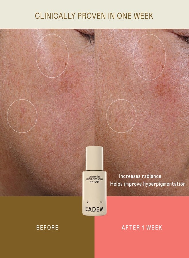 تونر إيديم اللطيف المقشر بحمض ألفا هيدروكسي وحمض فوسفاتيديل هيدروكسي، تونر الأرز الحليبي المقشر مع حمض اللاكتيك، وحمض الأزيليك، وحمض الترانيكساميك، مقشر ماء الأرز بحمض ألفا هيدروكسي ومصغر للمسام للوجه والجسم، 140 مل، مقشر الكشمير - Image 3