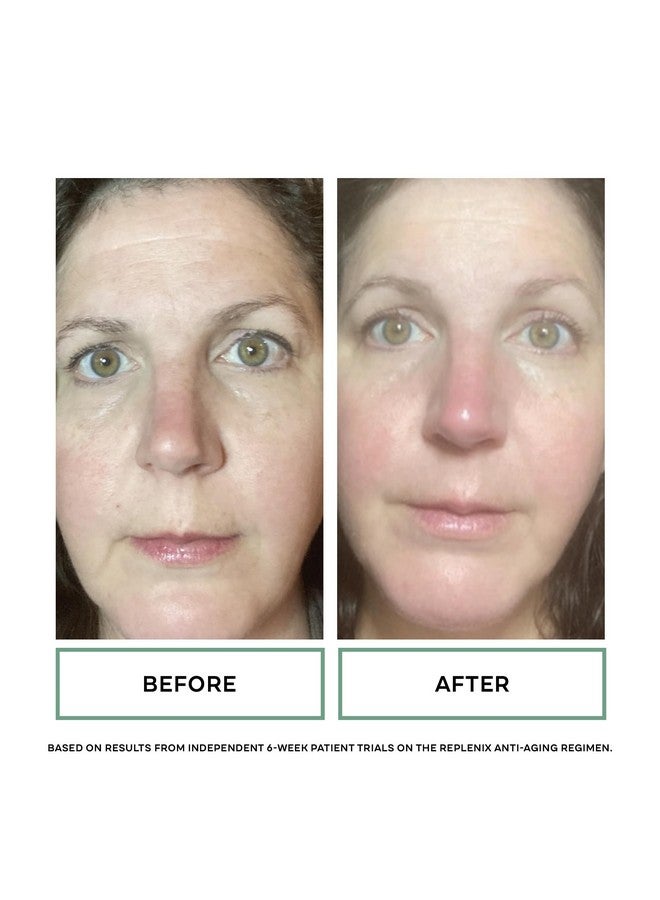 Replenix Pure Hydration Hyaluronic Acid Serum - Medical Grade Anti-Aging Treatment, Reduces Appearance Of Wrinkles, Uneven Skin Tone, Firming, 1 Oz. - Image 3