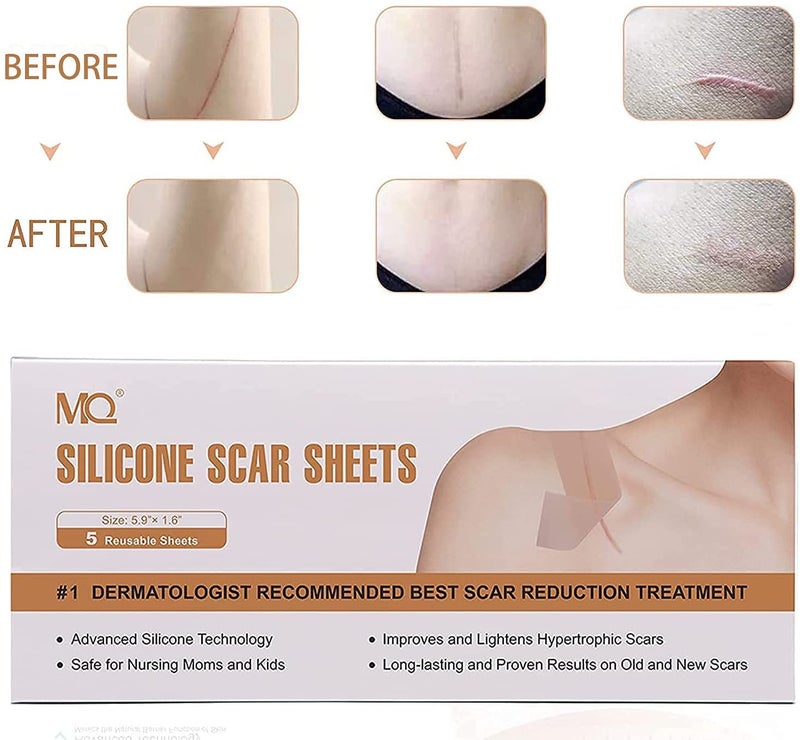 MQ 20PCS Silicone Scar - Image 4