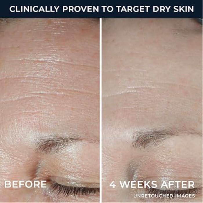 RoC Hydration+ Hyaluronic Acid Moisturizer Face Cream Fragrance Free Sensitive Face Moisturizer with Collagen Proteins 1.7 Ounces with Retinol Eye Cream Packette - Image 5