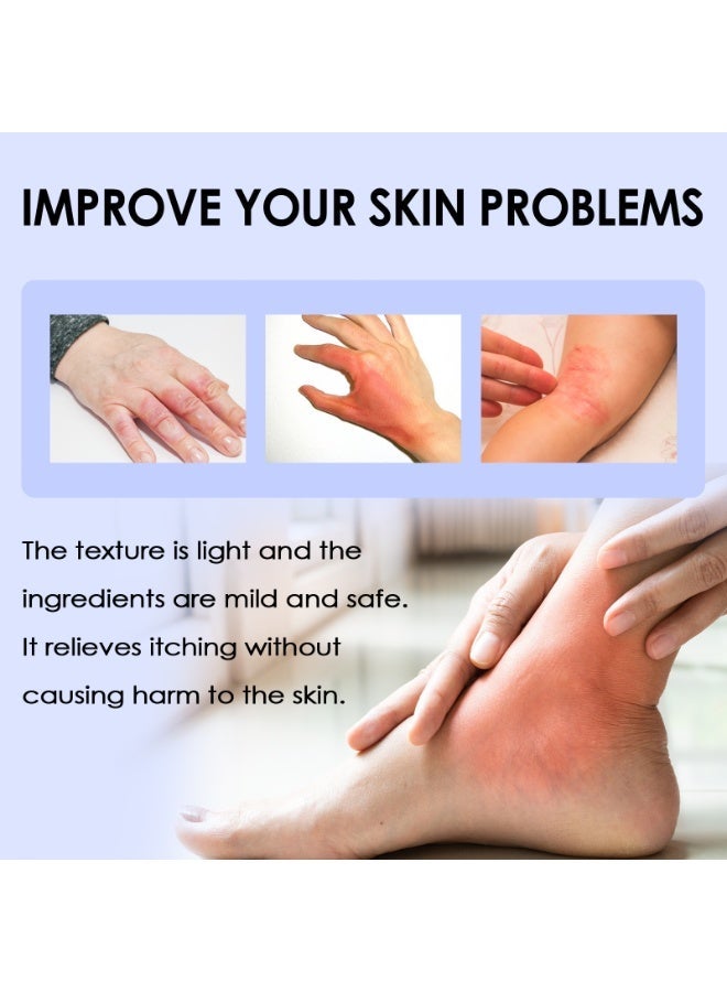 ساوث مون رذاذ مضاد للجراثيم للعلاج الصدفية أكزيما كريم مضاد للجراثيم مضاد للحكة التهاب الجلد - Image 3