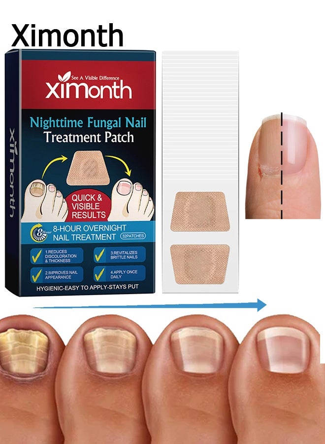 ximonth 32 Patches Nail Repair Patches - Toenail Fungus Treatment Patches - 8 Hour Nightly Renewal - Treats Damaged and Discolored Nails - Non-removable Toenail Fungus Treatment Patches - Image 1