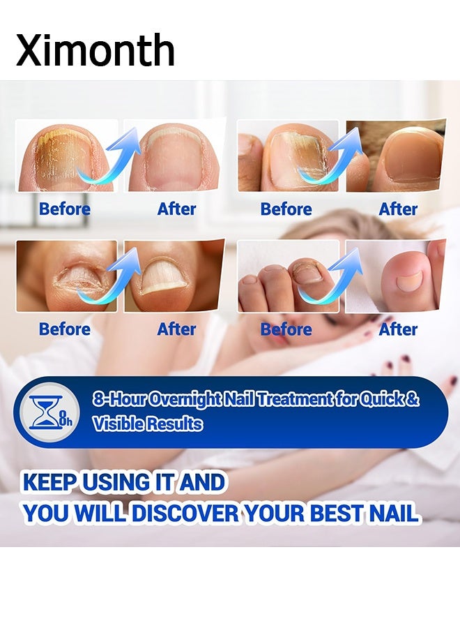 ximonth 32 Patches Nail Repair Patches - Toenail Fungus Treatment Patches - 8 Hour Nightly Renewal - Treats Damaged and Discolored Nails - Non-removable Toenail Fungus Treatment Patches - Image 4