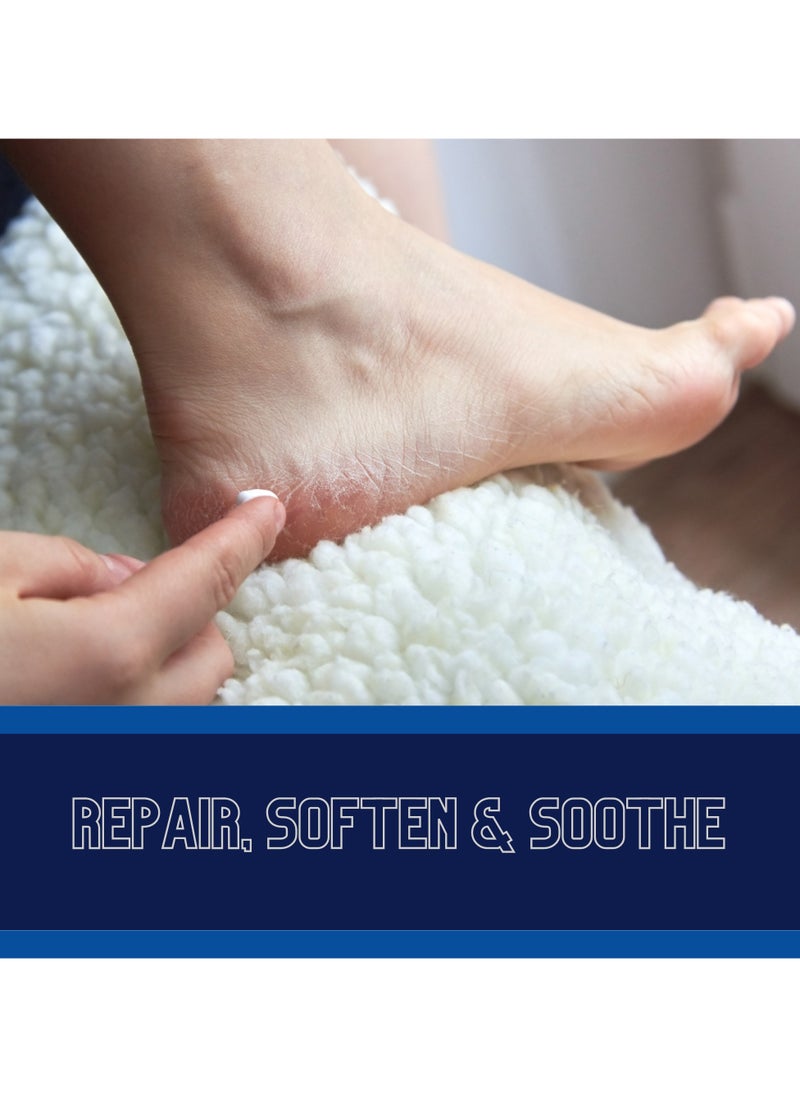 SZ Star Feet & Heel Cream for Dry Cracked Feet & Callouses - Moisturizing Foot Cream with Urea, Aloe Vera, Tea Tree, Turmeric, & Eucalyptus Extracts - Intensive Hydration for Rough, Dry, and Flaky Heels - (50g)  - Image 2