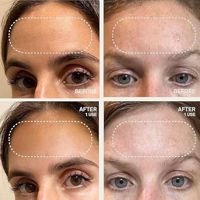 Dermaclara Forehead Patch - Forehead Wrinkle Patches for Face Overnight, Dermaclara Silicone Patches, Reusable for Face, Treatment for Wrinkles, Repair & Restore, Up to 30 Uses - 1 Patch - Image 5
