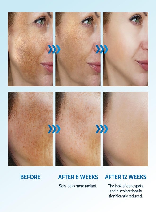 Abera Dark Spot Serum for Face, Dark Spot Corrector, Melasma & Age Spot Treatment, Boost Moisturization & Pore Minimize, All Skin Types, 0.68 fl Oz, Set of 2 - Image 5