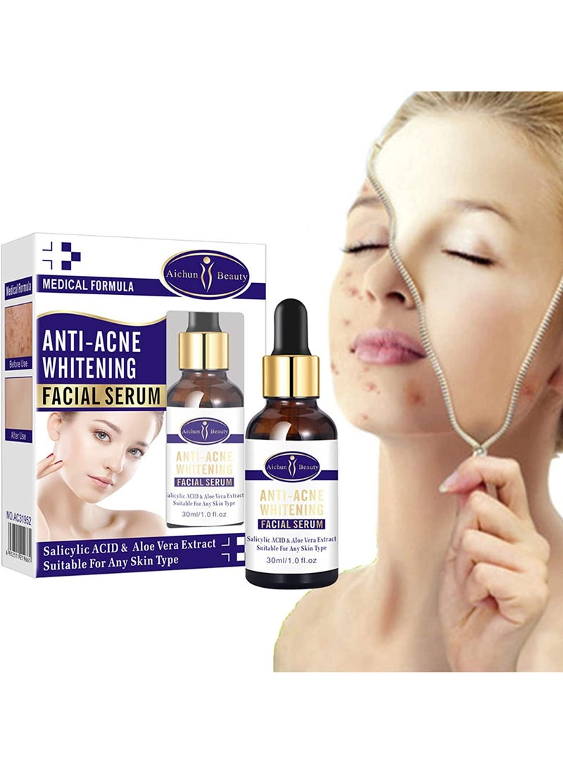 Aichun beauty AICHUN BEAUTY Anti-Acne Facial Serum Aloe Vera Extract Salicylic Acid Repairs Damaged Skin 30ml, Scar Removal Facial Serum Pimples Stretch - Image 4