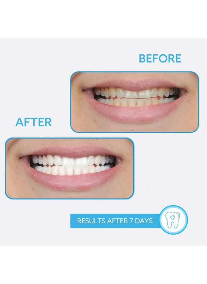 Go Smile - On The Go Teeth Whitening (Whitening Pen (2 Pack) - Image 1