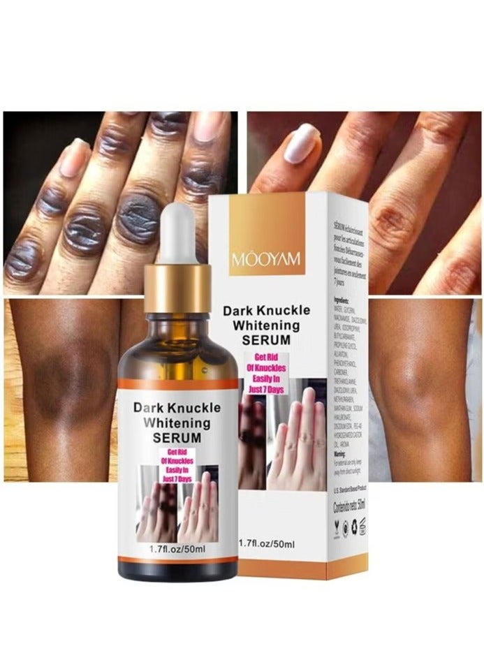MOOYAM Dark Knuckle Whitening Serum 50ml for Hands and Feet 7 Day Brightening Treatment Improves Dark Spots and Dullness Exfoliates Rough Skin for Men and Women  - Image 1