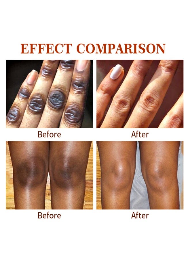 MOOYAM Dark Knuckle Whitening Serum 50ml for Hands and Feet 7 Day Brightening Treatment Improves Dark Spots and Dullness Exfoliates Rough Skin for Men and Women  - Image 3