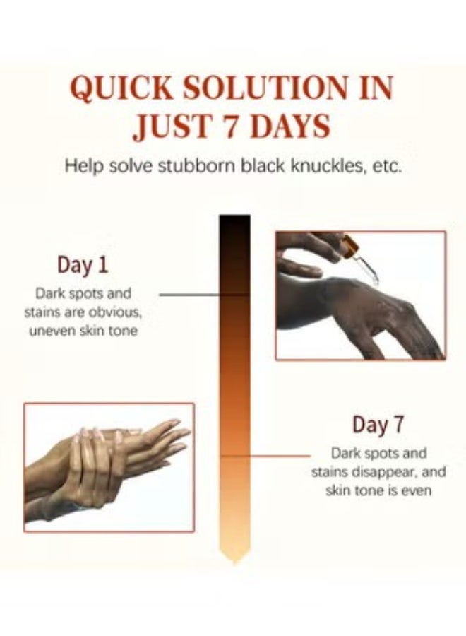 MOOYAM Dark Knuckle Whitening Serum - Skin Whitening Oil Brightening Dark Spots,Elbow Armpit Whitening Skin Whitening Knee Melanin for Men and Women 50ML - Image 4