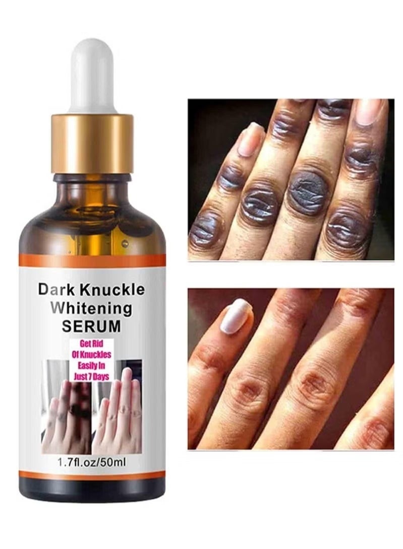 MOOYAM Dark Knuckle Whitening Serum 50ml, Skin Whitening Oil for Elbow Armpit Knee, Brightens Dark Spots & Melanin, Whitening and Brightening, Moisturizing Repair, Elastic and Smooth Skin - Image 1