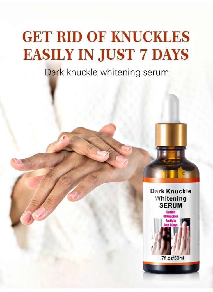 MOOYAM Dark Knuckle Whitening Serum 50ml, Skin Whitening Oil for Elbow Armpit Knee, Brightens Dark Spots & Melanin, Whitening and Brightening, Moisturizing Repair, Elastic and Smooth Skin - Image 2