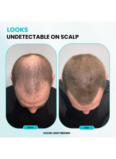 SureThik Hair Fibers For Thinning Hair Building Hair Fibers To Conceal Thinning Hair Instantly Fuller Looking Hair For Men & Women Dark Brown 30G  - Image 5