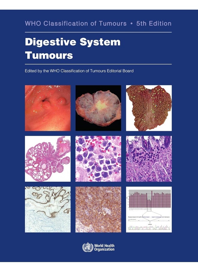 Digestive System Tumours: Who Classification of Tumours 