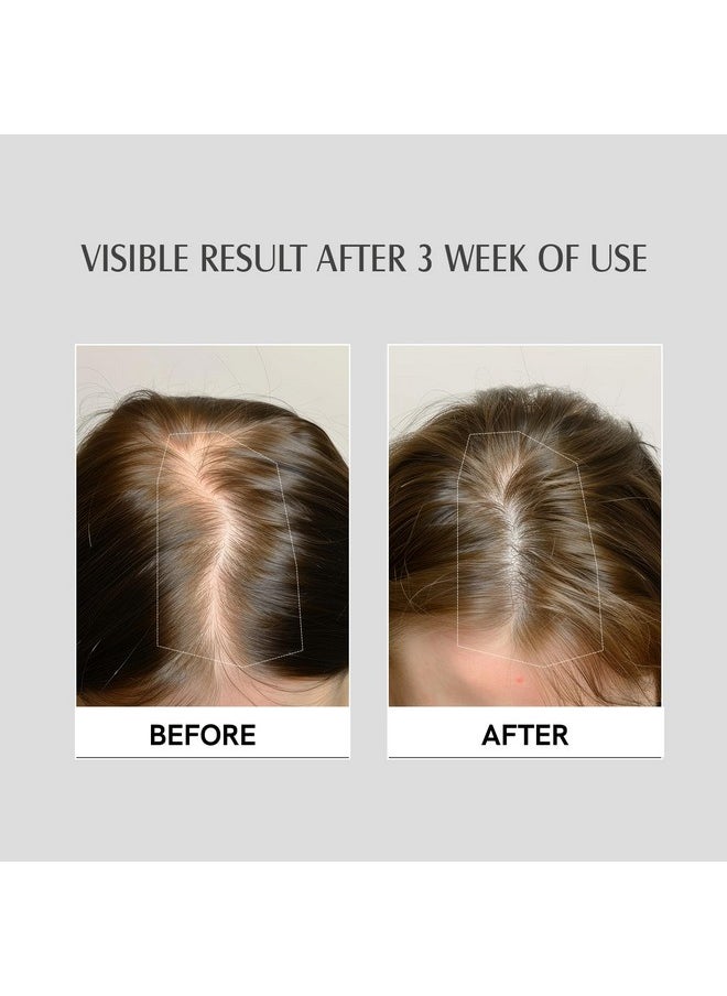 Aravi Organic Hair Growth Serum With 3% Redensyl, 2% Anagain, 2% Procapil - For Hair Growth And Hair Fall Control - For Men & Women - 30 Ml  - Image 5
