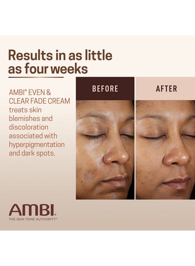 ambi Even & Clear Fade Cream Hydroquinonefree Hyperpigmentation Treatment Dark Spot Corrector Results In As Little As 4 Weeks Niacinamide Aloe Vera Vitamin C 1 Fl Oz  - Image 5