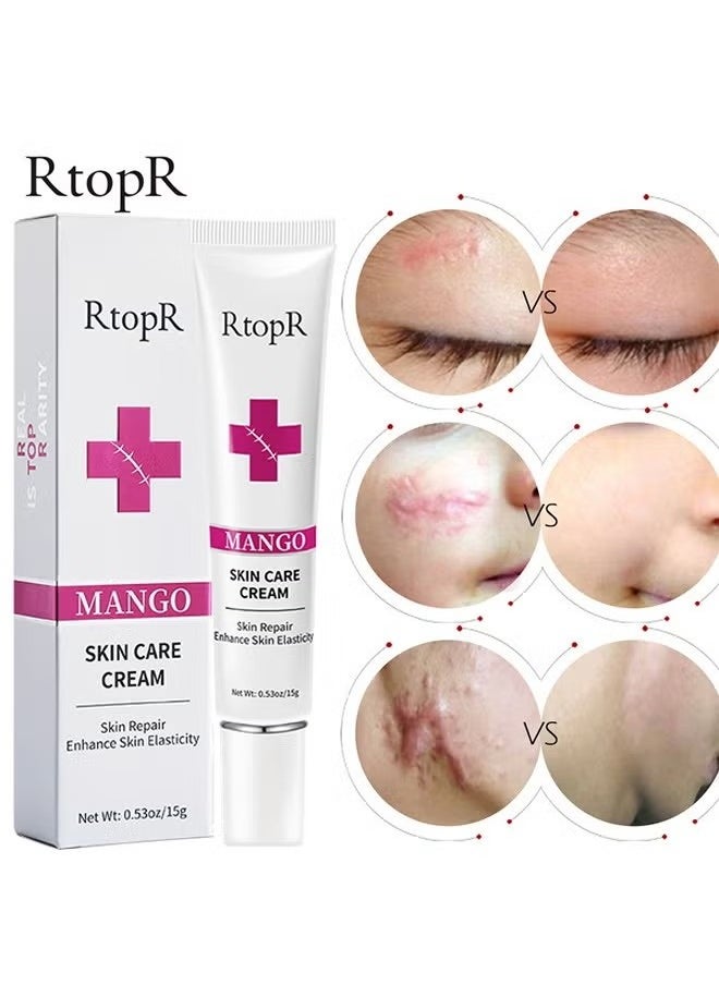 RtopR - Mango Skin Care Cream，Scar Removal Anti Scar Skin Repair，Skin Repair Creams Treatment Stretch Marks Acne Surgical Care 15g - Image 1