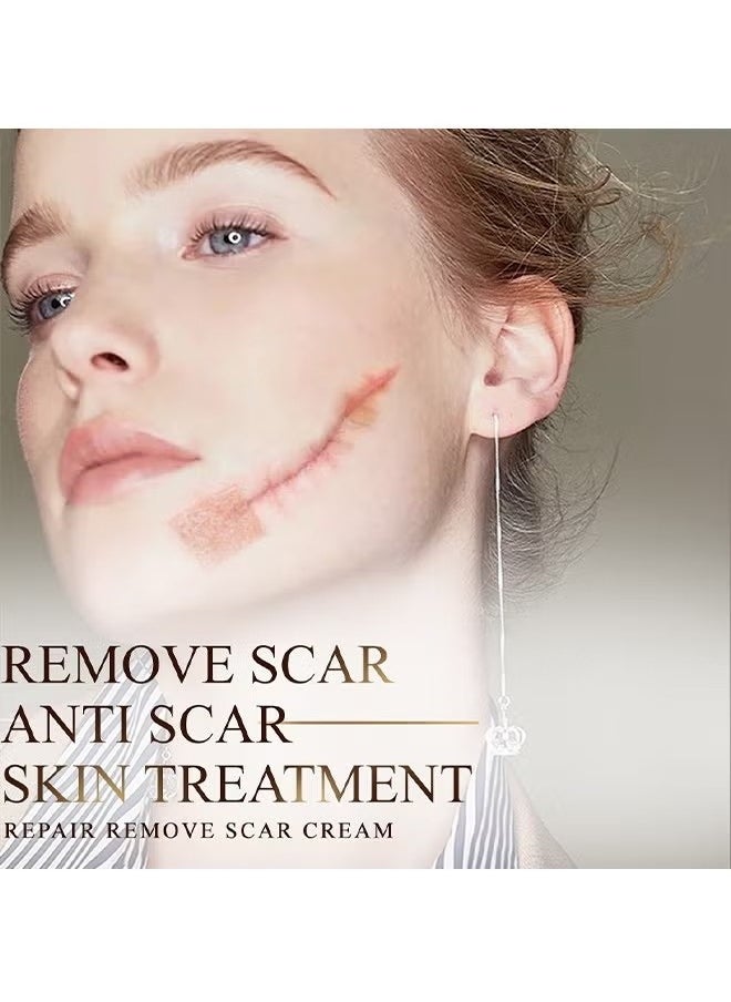 RtopR - Mango Skin Care Cream，Scar Removal Anti Scar Skin Repair，Skin Repair Creams Treatment Stretch Marks Acne Surgical Care 15g - Image 1