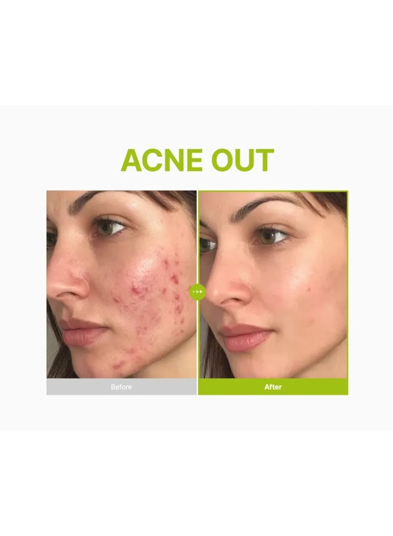 Purito - Azelaic Acid 10 Kojic Tea Tree Serum -30 ml - Image 2
