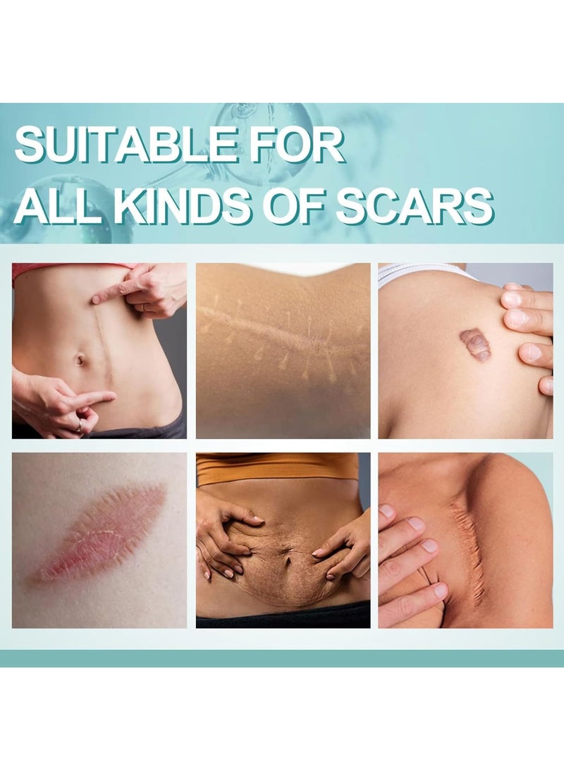 KASTWAVE KASTWAVE Scar Gel, Fades Stretch Marks Away, Scar Removal Cream for Surgical Scars, Burns, Acne, Keloid Bumps,C Section Scars, For Adults & Kids, 50ml  - Image 3