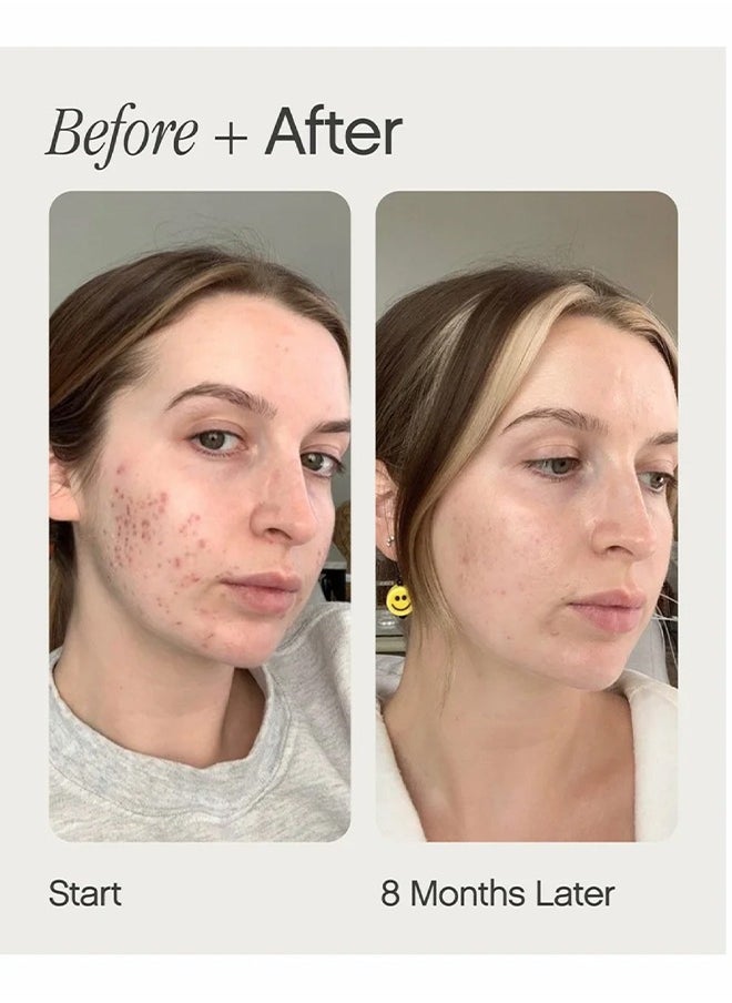 TOPICALS Brightening & Clearing Serum For Uneven Skin Tone - Mini Faded Serum for Dark Spots  - Image 3