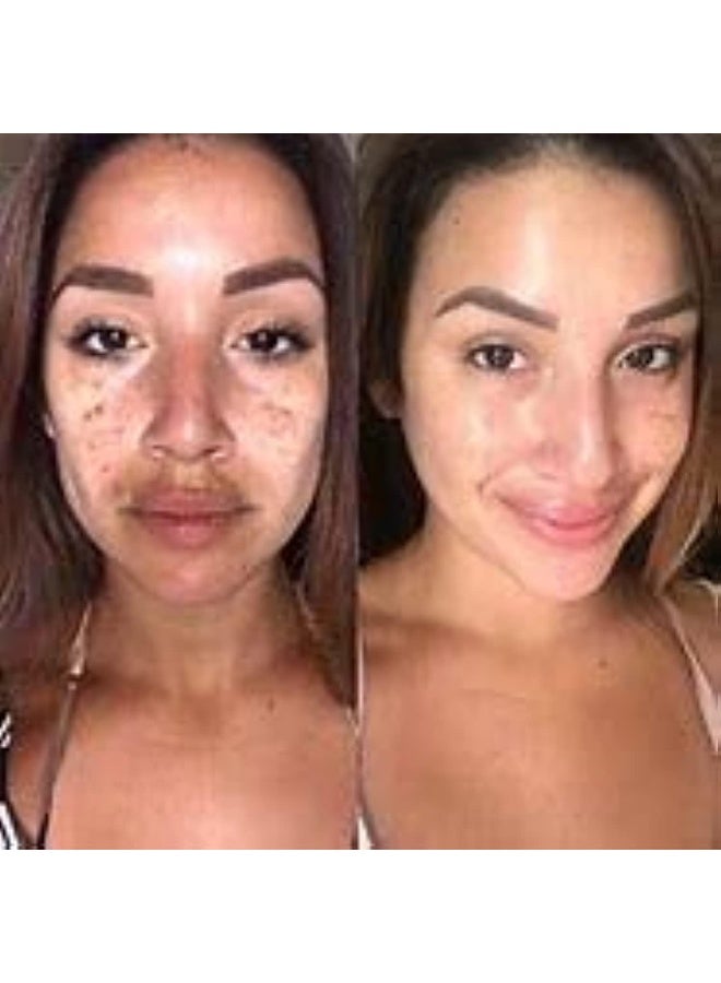 قناع عصا الشاي الأخضر الطيني المنقي - Image 3