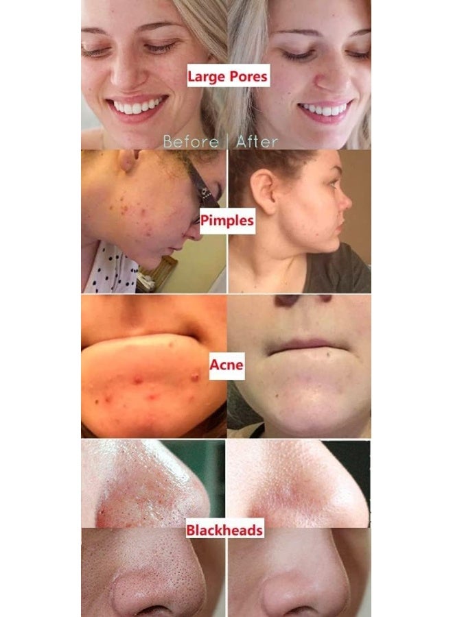 قناع عصا الشاي الأخضر الطيني المنقي - Image 5