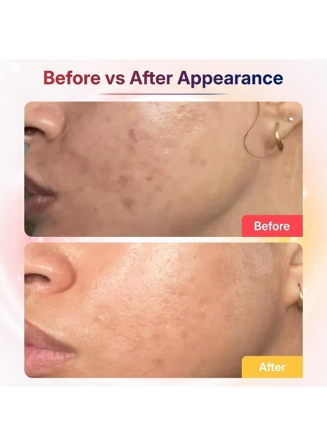 ATTRACTIVE GT Attractive LED Facial Radiance Mask for Glowing Skin | Light Therapy Mask for Anti-Aging, Acne Care & Skin Rejuvenation | Rechargeable face mask for Men & Women - Image 4
