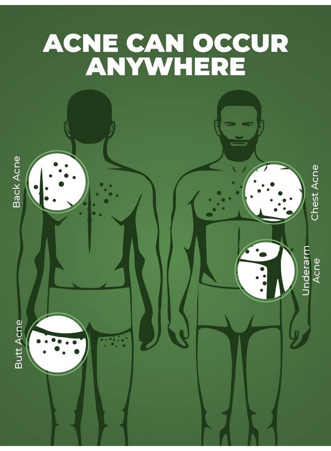 BEARDO Body Acne Clear Body Wash For Men 200 Ml | With Neem, Tea Tree And Salicylic Acid | Clean Clear Skin | For Body Acne And Skin Purification | B-Acne - Image 4