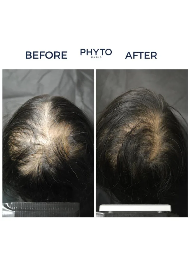 Phyto Phyto Cyane Densifying Hair Serum For Women