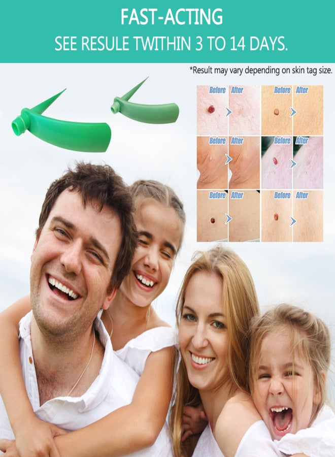 2-4MM/4-8MM Skin Tag Removal Kit Skin Tag Remover Skin Mole Wart Remover Micro Band Skin Tag Removal Kit with Cleaning Pads Mole Face Care - Image 4