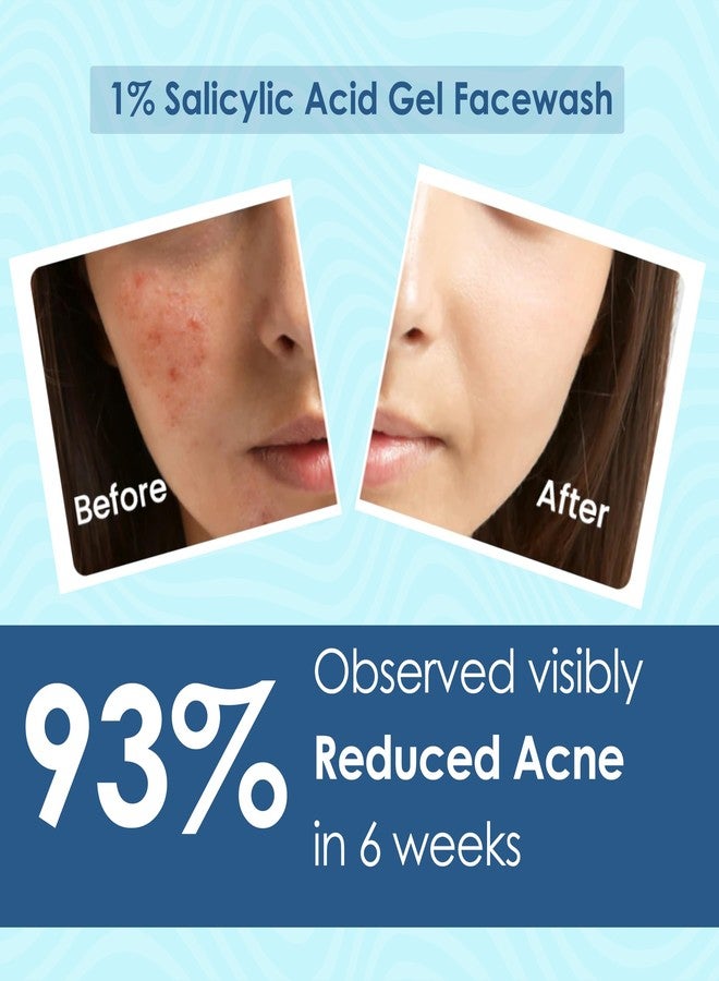 Pink Root 1% Salicylic Acid Gel Face Wash with kojic Acid for acne skin & bumpy Skin - 100 ml - Image 2