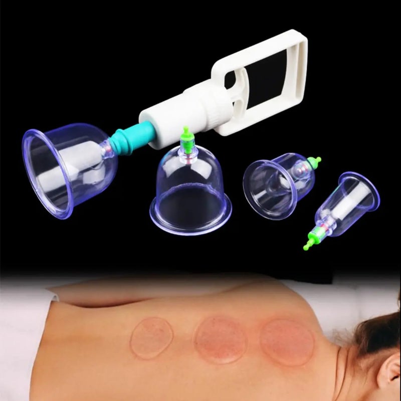 CAVERNSHOP Cupping Therapy Cups Kit Set 12 Pcs Vacuum Cupping Set Health Care Body Relaxation Massage Manual Therapy Kit, Medical Cupping Set, Acupuncture for Cupping Massage Back Pain Relief - Image 5