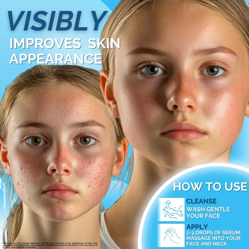 ERASE Spotless Serum Vitamin C Serum for Dark Spots with Niacinamide 5 Korean Skin Care Proactive Acne Treatment For Face Hyaluronic Acid Hydration Soothing Turmeric Centella Asiatica 1fl oz - Image 5