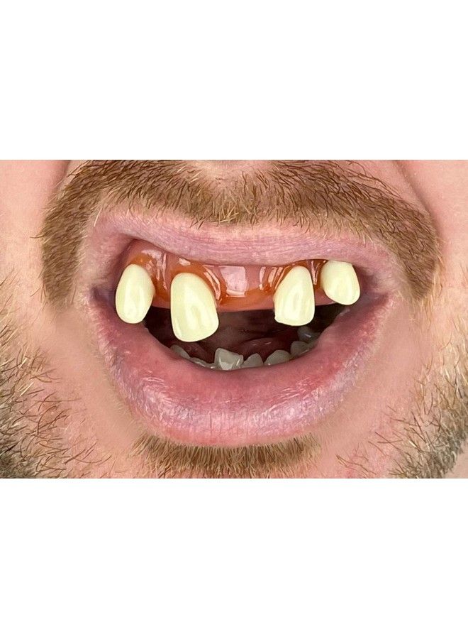 Billy-Bob Tiger Teeth Every Smile Is Exotic!  - Image 1