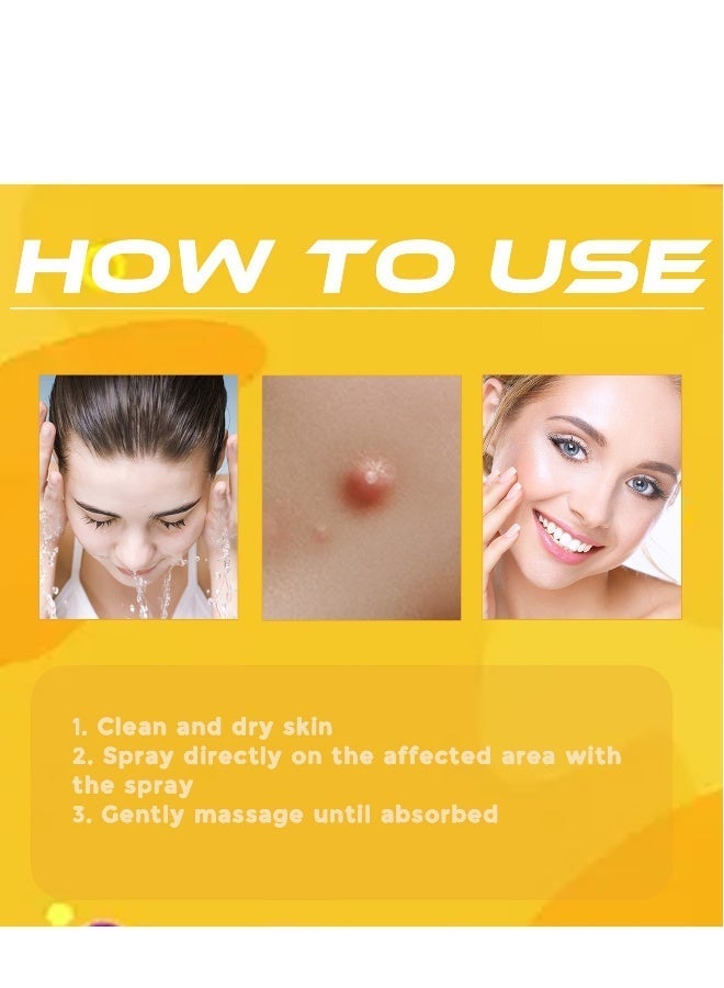 SOL LORA Tag Recede Bee Venom Repair Spray, A Gentle Safe Portable Wart Removal Spray with Natural Extracts for All Skin Types，Universal for Both Men and Women Wart Removal .Protecting Health and Beauty. - Image 5