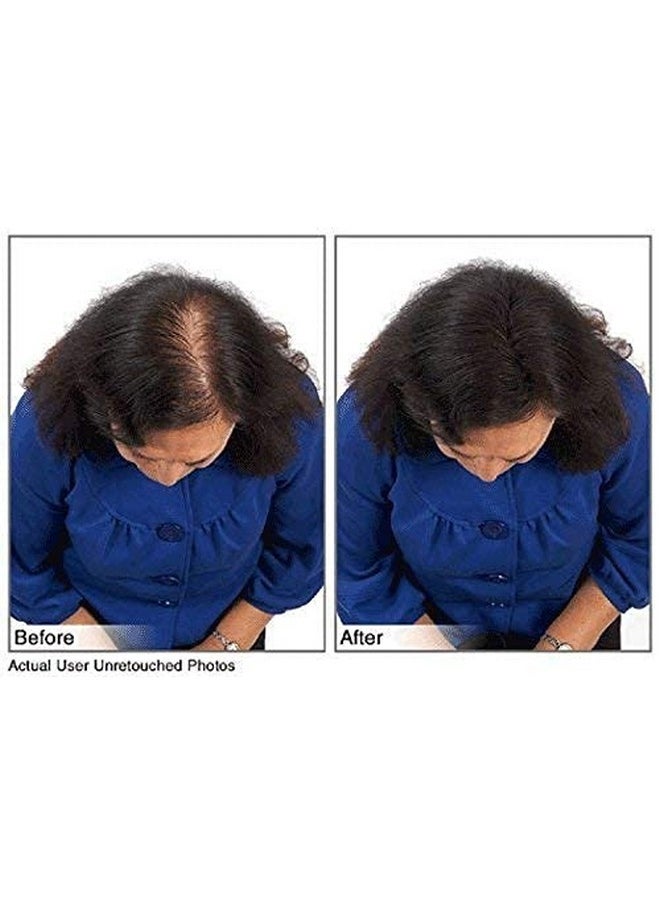 Juveker Hair Building Fibers Instantly Conceal Thinning Hair And Bald Spots For Men & Women (Large 28 Grams Bottle) Undetectable Washes Away For All Hair Types No Animal Byproducts (Black)  - Image 5