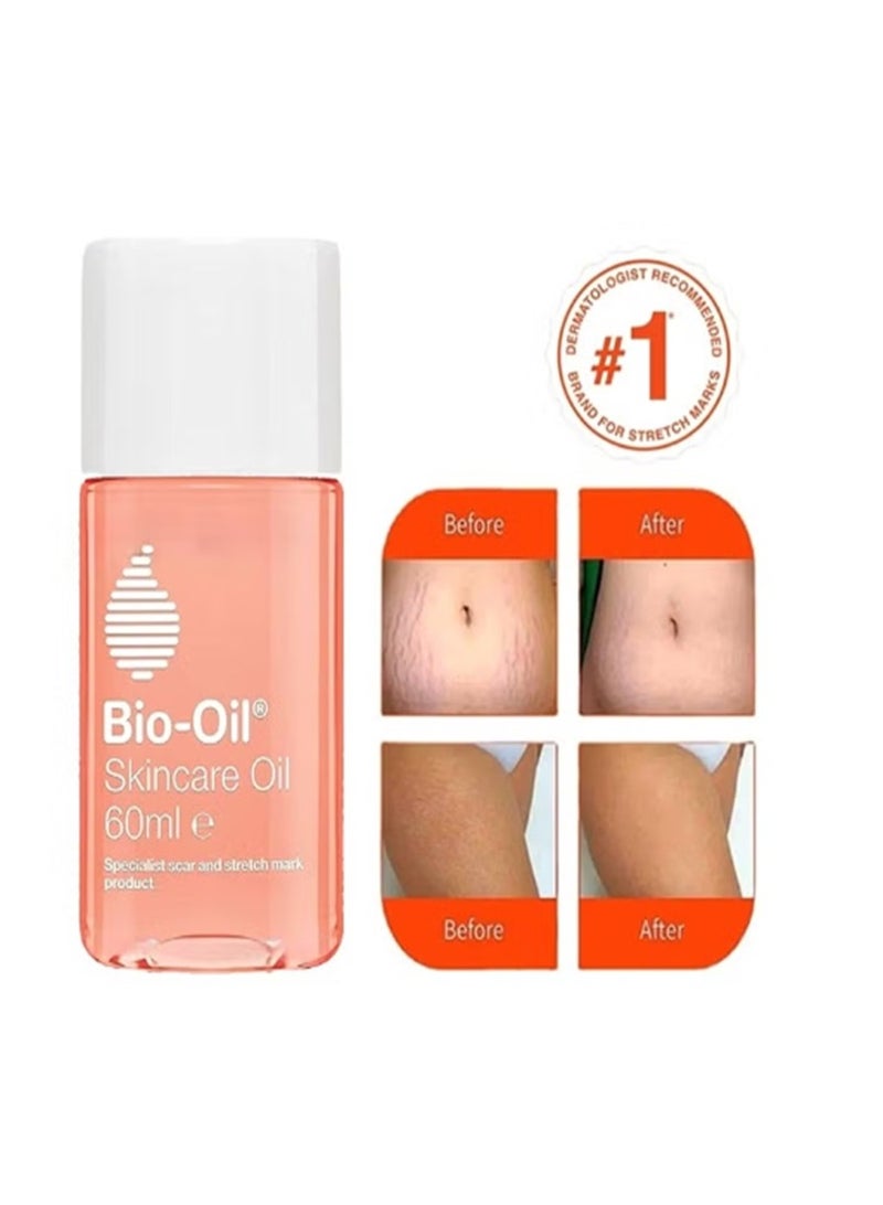 Bio-Oil Skincare Body Oil 60mL, Body and Face Moisturizer, Vitamin E Serum For Scars and Stretch Marks, Suitable For All Skin Types, Help Improve The Appearance of Both New or Old Scars, Skincare Oil Serum - Image 1