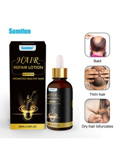 Hair Repair Lotion, Hair Oil, Hair Loss Treatment, Moisturizing Anti Loss Hair Growth Essence, Promote Healthy Hair, Strengthen Hair Growth 30ml